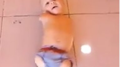 Child Without Arms and Feet